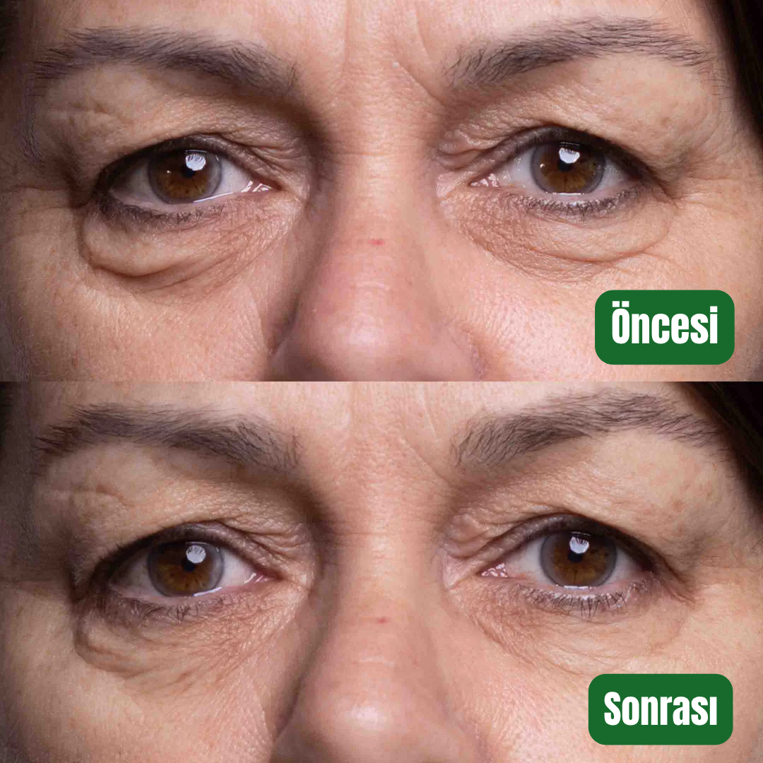 Aliyra Doğal Sıkılaştırıcı Balmı – %100 Saf Doğal Formül