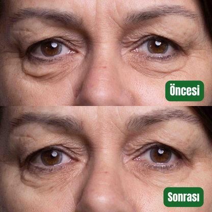 Aliyra Doğal Sıkılaştırıcı Balmı – %100 Saf Doğal Formül