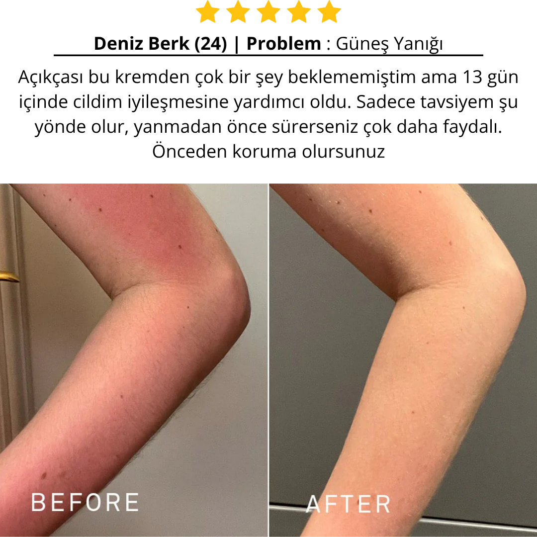 Aliyra Güneş Sonrası Onarım Balm